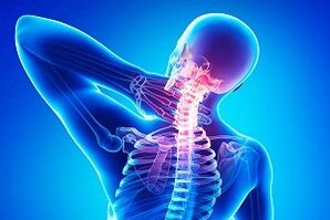 болки в гърба като симптом на остеохондроза