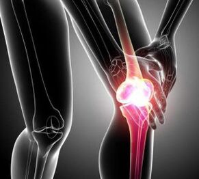 болка в коляното при артрит и артроза