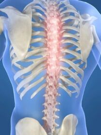 гръбначна лезия при гръдна остеохондроза
